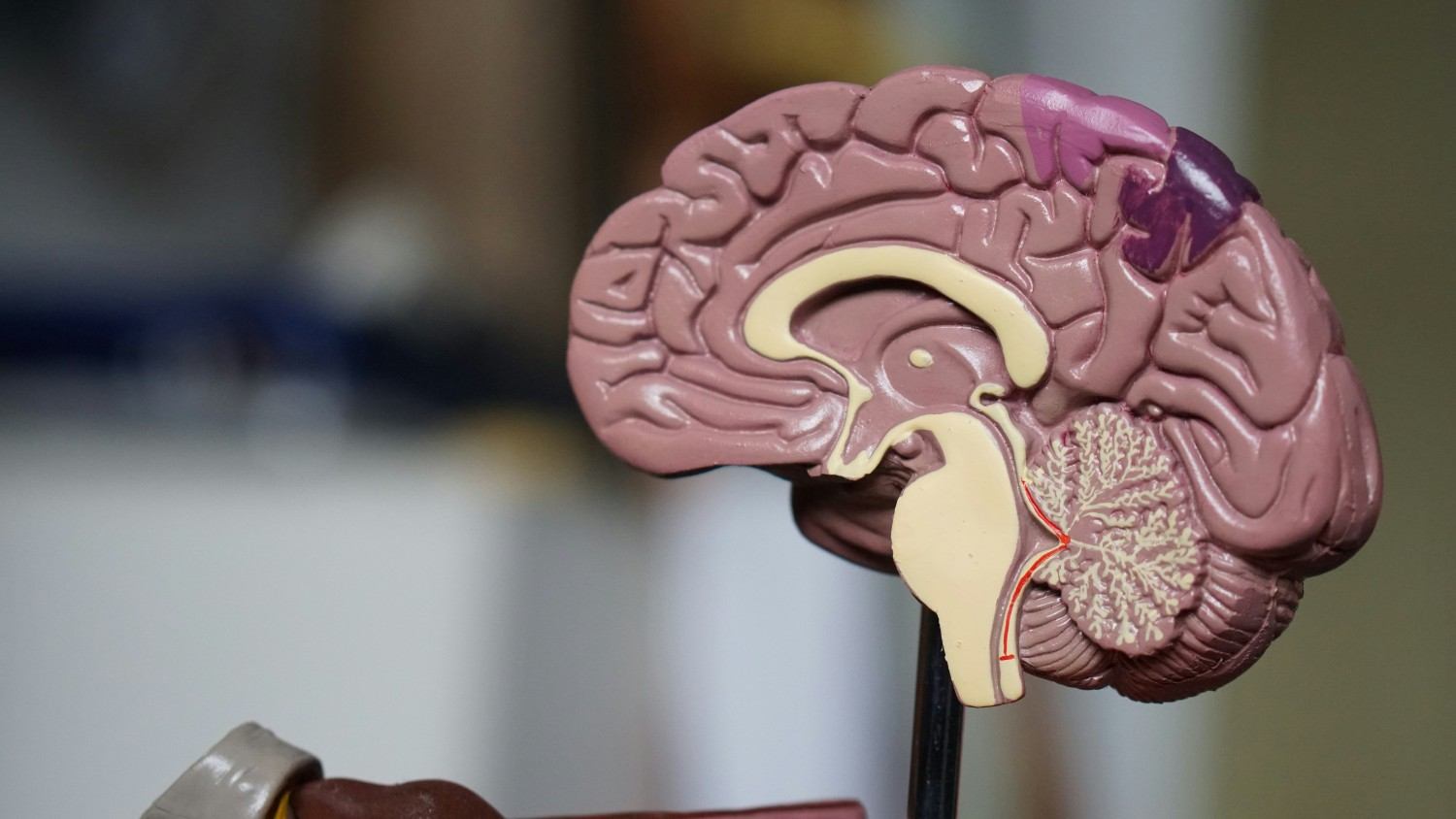 Expert Neurology Care with Advanced Technology by the Best Neurologist in Greater Noida