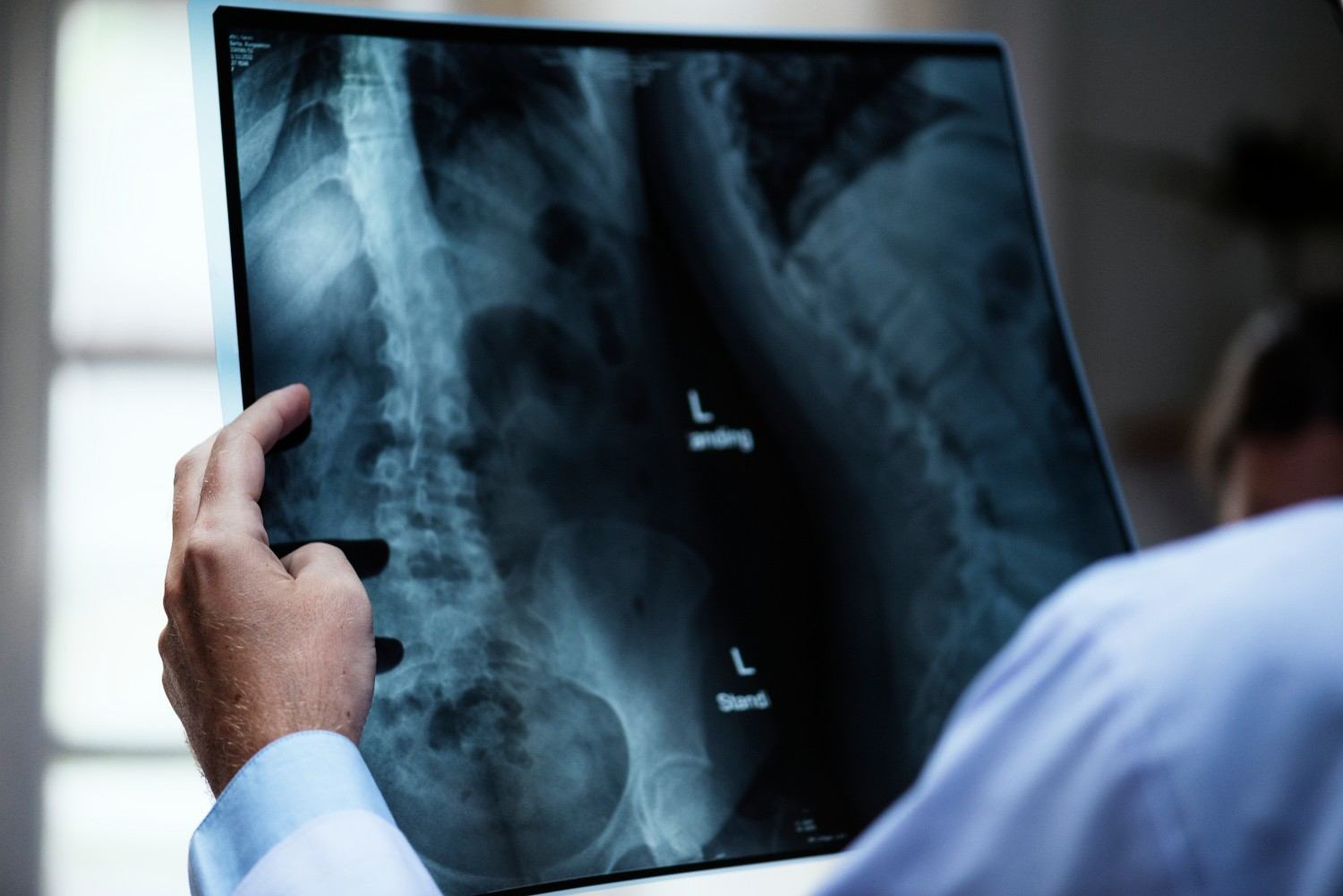 Back Pain and Spine Disorders: When to See the Best Spine Surgeon in Greater Noida